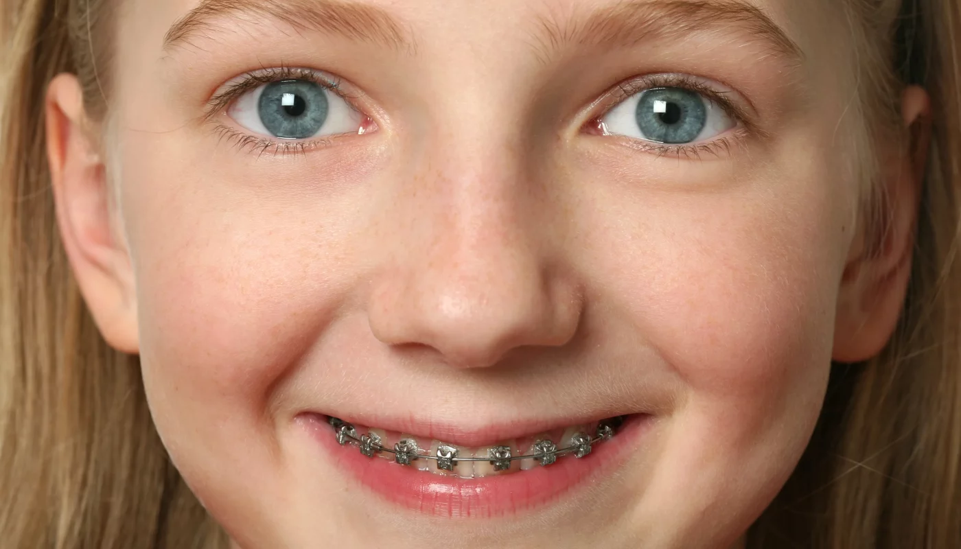 Braces For Children Arvada